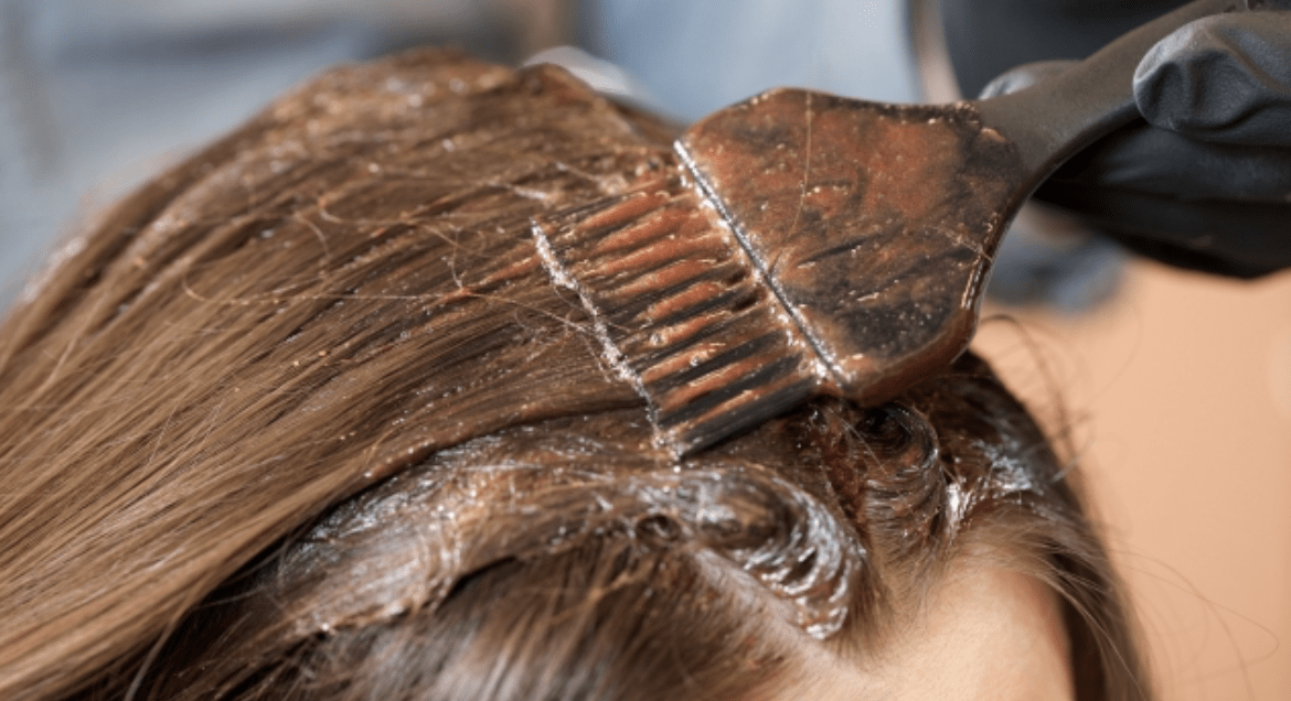 カラー後 頭皮 かゆみ 1692